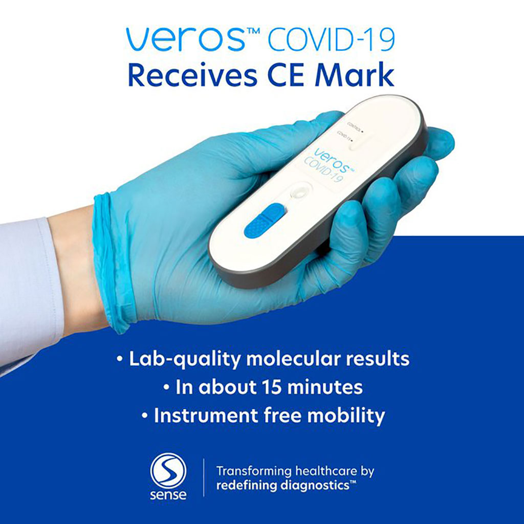 Image: The all new Veros COVID-19 has received CE Marking (Photo courtesy of Sense Biodetection Limited)