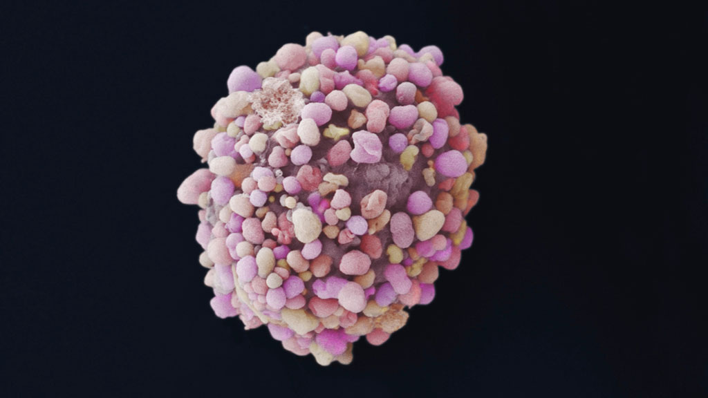 Image: Representation of a breast cancer cell (Photo courtesy of Anne Weston, Francis Crick Institute via the Wellcome Collection)