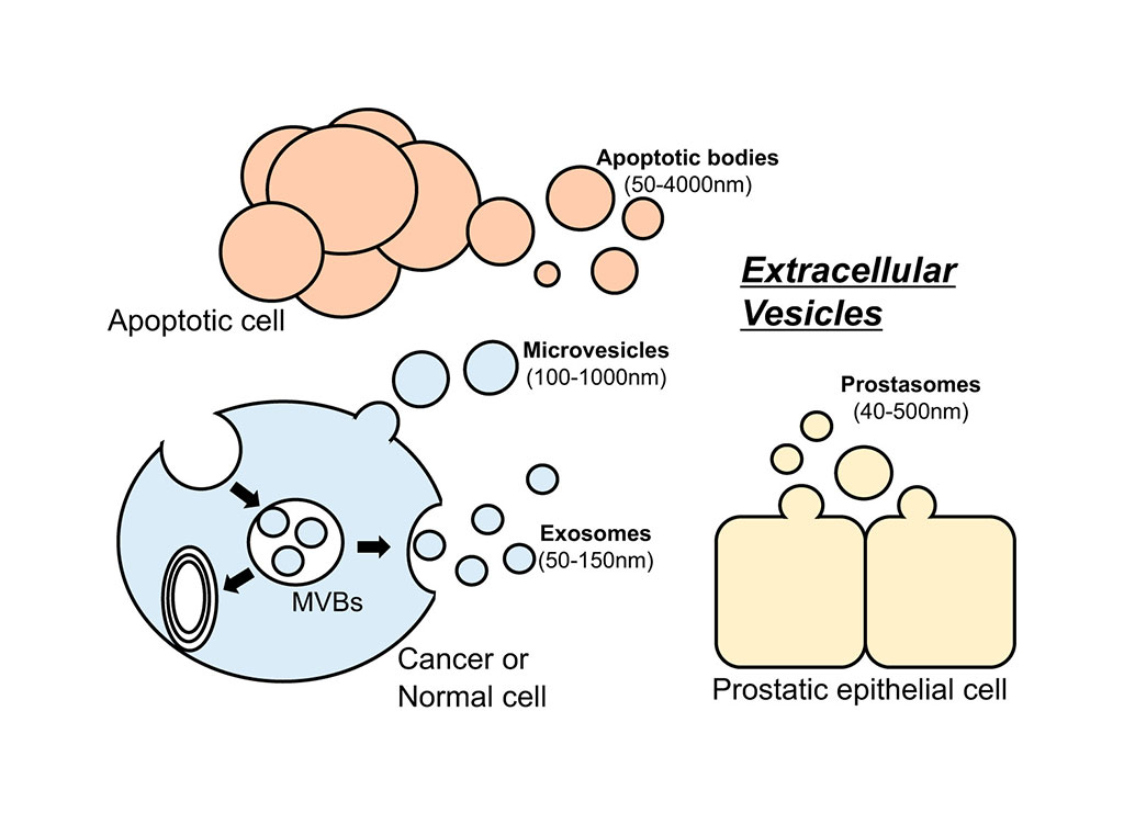 Image: Various kinds of extracellular vesicles (EVs) (Photo courtesy of American Physiological Society)