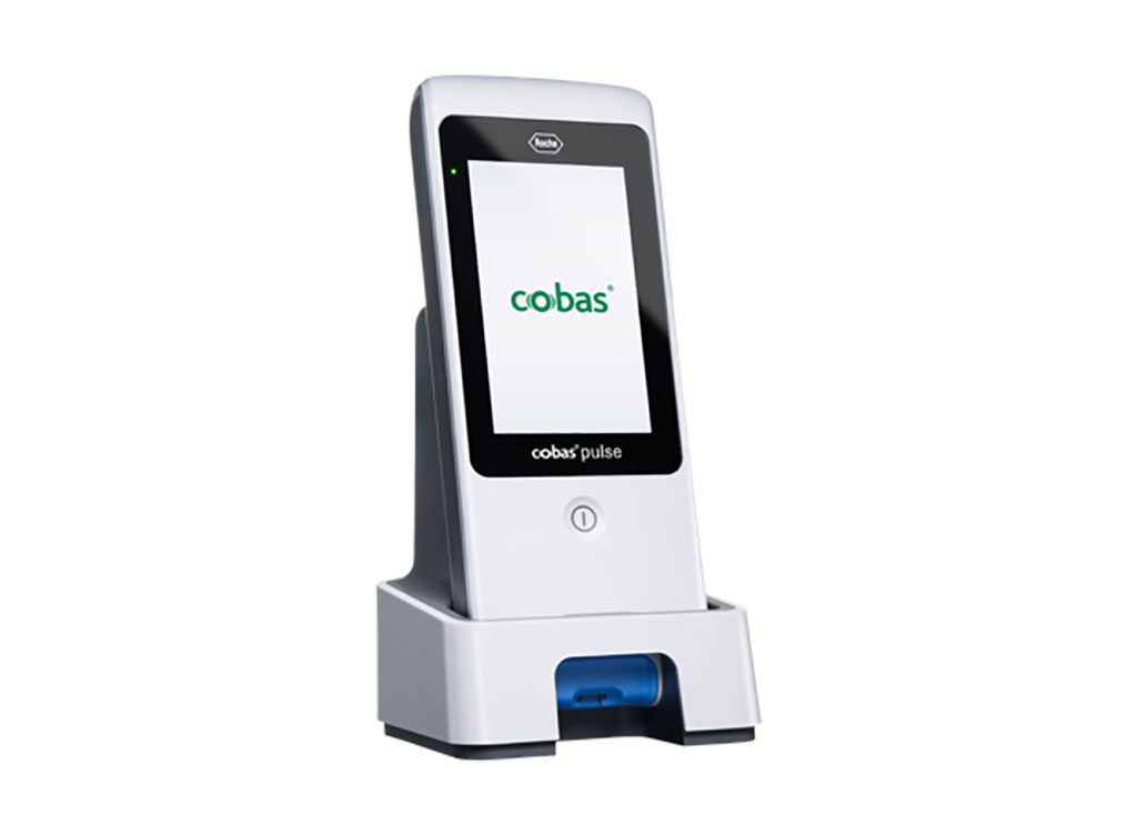 Image: cobas® pulse system (Photo courtesy of Roche Diagnostics)