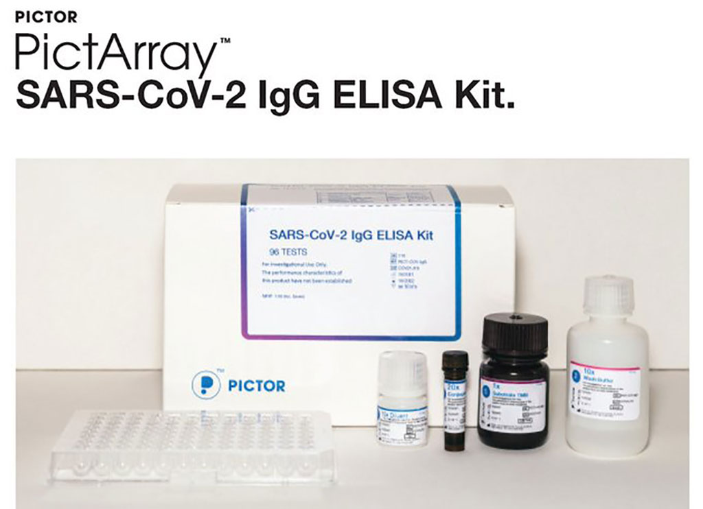 Image: PictArray SARS-CoV-2 assay (Photo courtesy of Pictor Limited)
