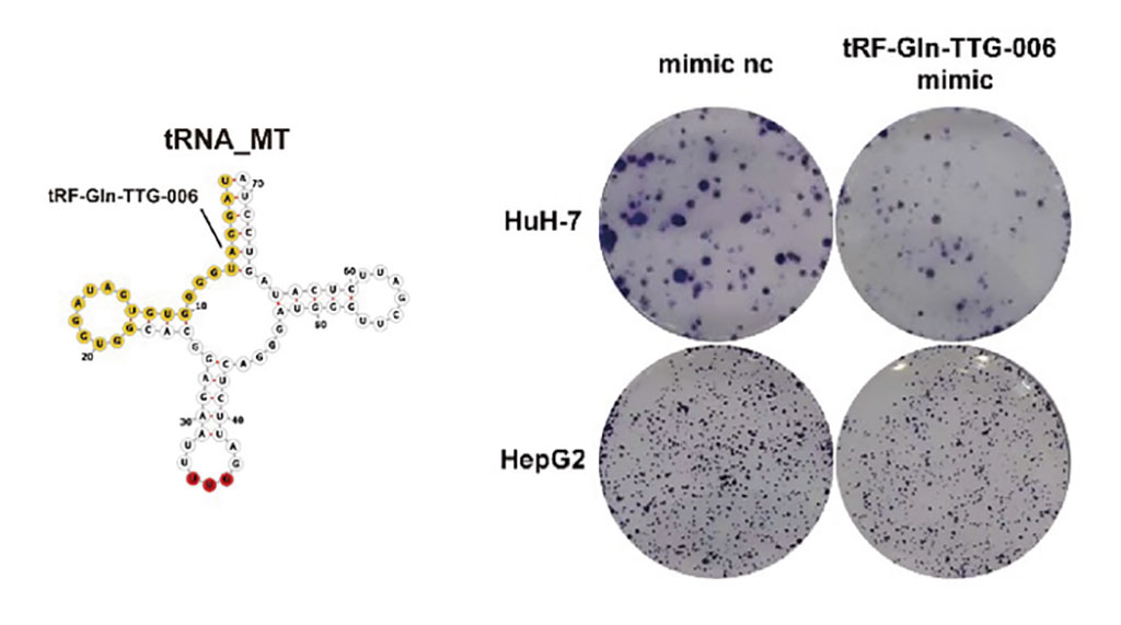 Image: Position of tRF-gln-ttg-006 in the cloverleaf secondary structure (left) and its inhabited ability for colony formation of two HCC cell lines (right) (Photo courtesy of Higher Education Press Limited Company)