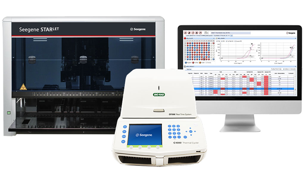Image: All-in-One Platform performs molecular diagnostic tests for infectious diseases (Photo courtesy of Seegene)