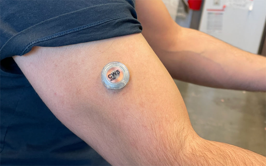 Image: The device can be worn on the upper arm while the wearer goes about their day (Photo courtesy of UC San Diego)