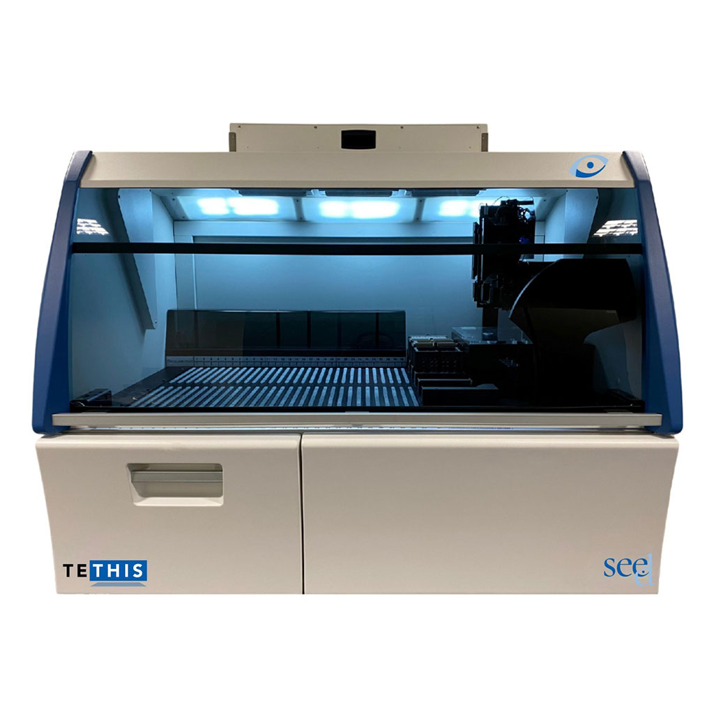 Image: See.d is the first fully automated, standardized pre-analytical platform for comprehensive liquid biopsy testing (Photo courtesy of Tethis)