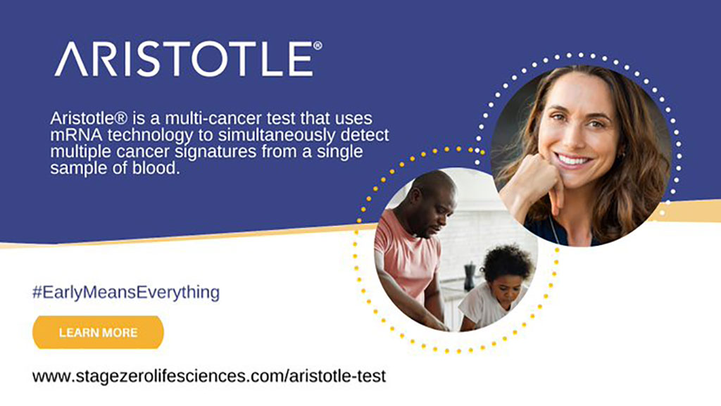 Image: Aristotle blood test detects molecular signatures of multiple cancers from single blood sample (Photo courtesy of StageZero Life Sciences)