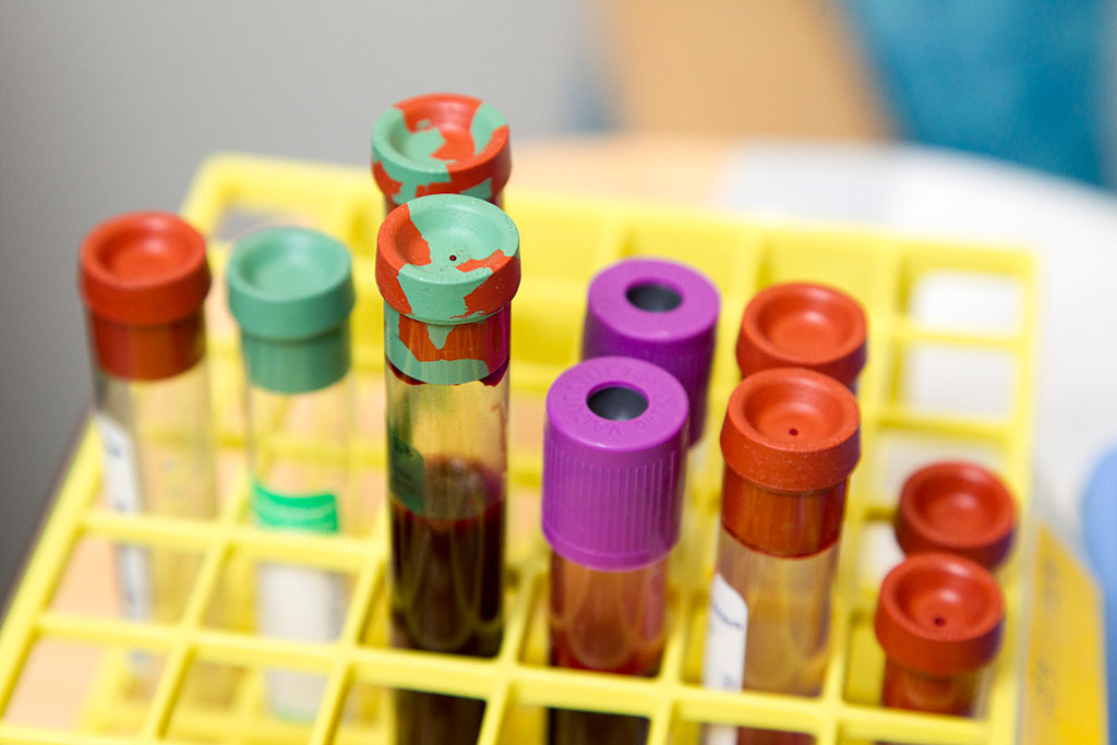 Image: A biomarker will enable Parkinson’s disease to be diagnosed from blood samples (Photo courtesy of Unsplash)