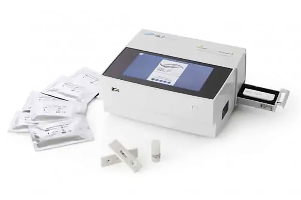 Image: suPARnostic Quick Triage kit is used in POC situation for early warning and patient triaging (Photo courtesy of ViroGates)