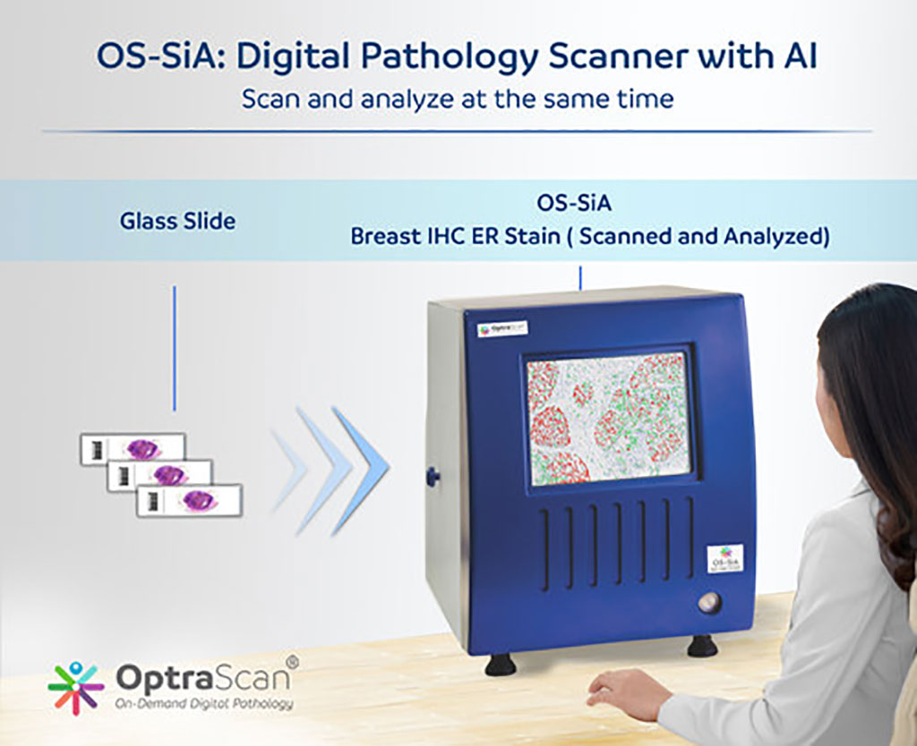 Image: OS-SiA: Digital Pathology Scanner with AI (Photo courtesy of OptraSCAN)