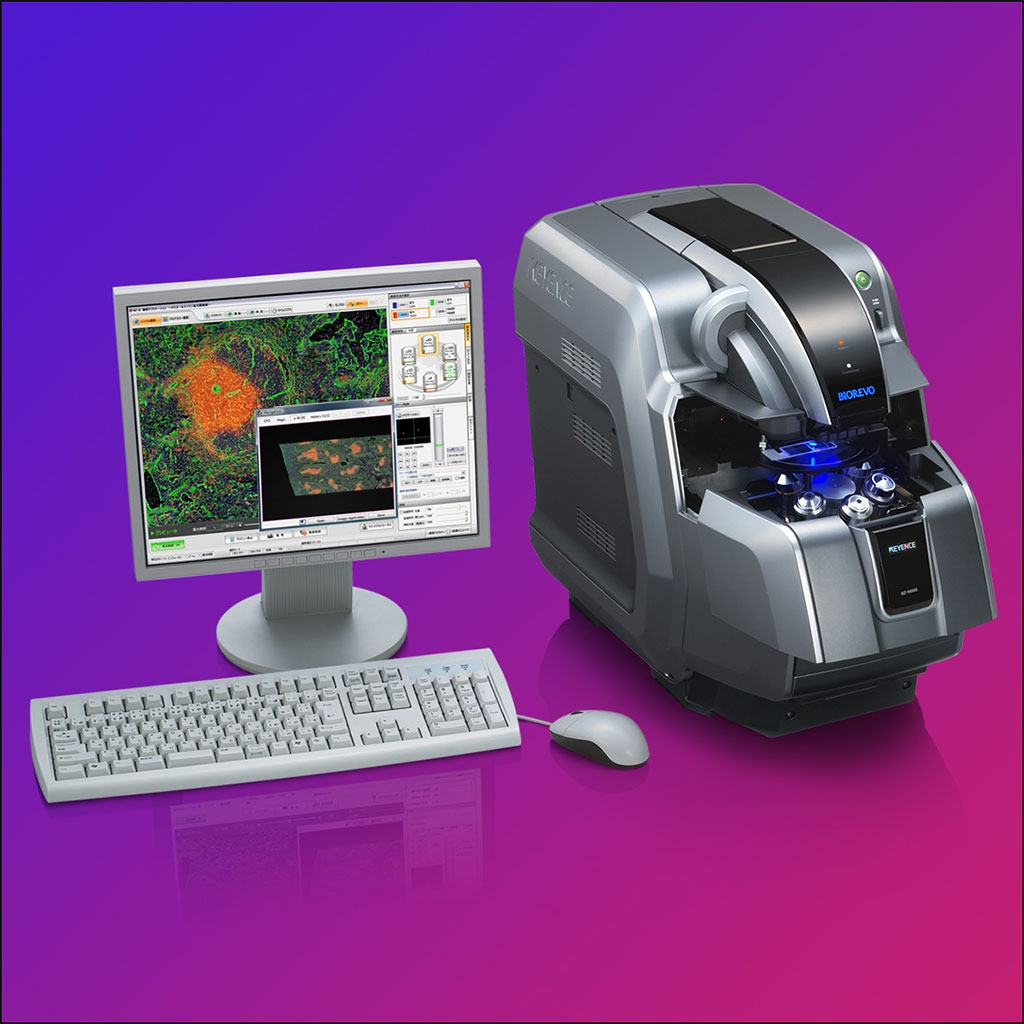 Image: The Keyence BZ-9000 BIOREVO microscope system performs fluorescence, brightfield, and phase-contrast imaging on a variety of specimen holders without the need for a darkroom (Photo courtesy of LASER FOCUS WORLD)