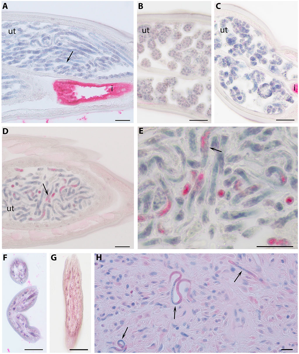 Image: Immunolocalization of BmR1 homologues showing immunohistochemical results from worm sections that were processed (Photo courtesy of Washington University School of Medicine)