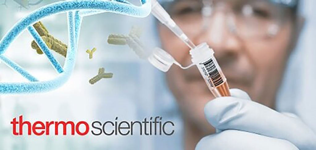 Image: New blood tests aid in diagnosing systemic sclerosis and systemic lupus erythematosus (Photo courtesy of Thermo Scientific)