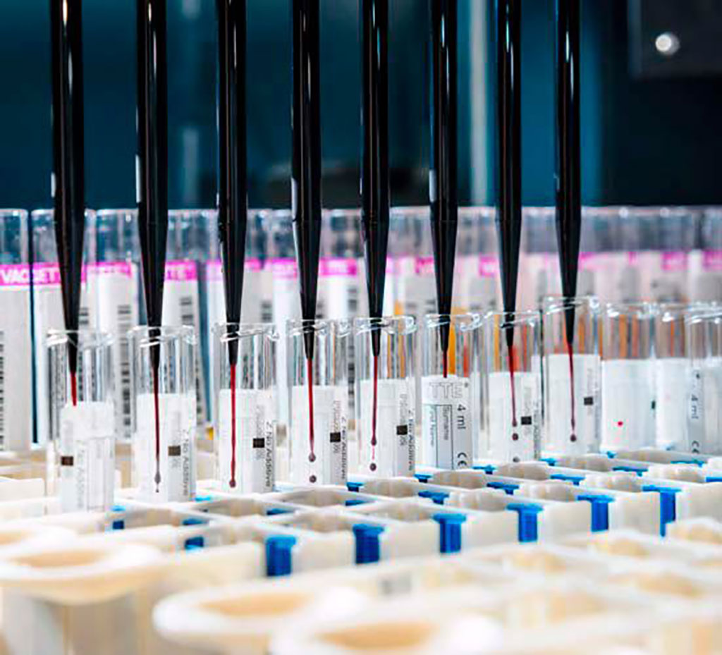 Image: Helsinki Biobank collects and releases biological samples with associated data for high-quality biomedical research (Photo courtesy of Helsinki Biobank)