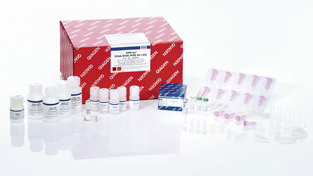 Image: The AllPrep DNA/RNA FFPE Kit is used for simultaneous purification of genomic DNA and total RNA from formalin-fixed, paraffin-embedded tissue sections (Photo courtesy of Qiagen)
