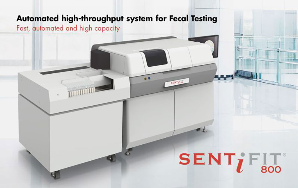 Image: New SENTiFIT 800 analyzer for fecal immunochemical testing (Photo courtesy of Sentinel Diagnostics)