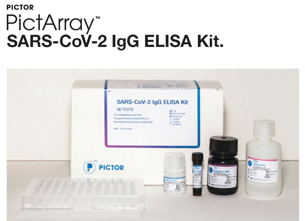 Image: PictArray SARS-CoV-2 Antibody Test has received CE Mark (Photo courtesy of Pictor)