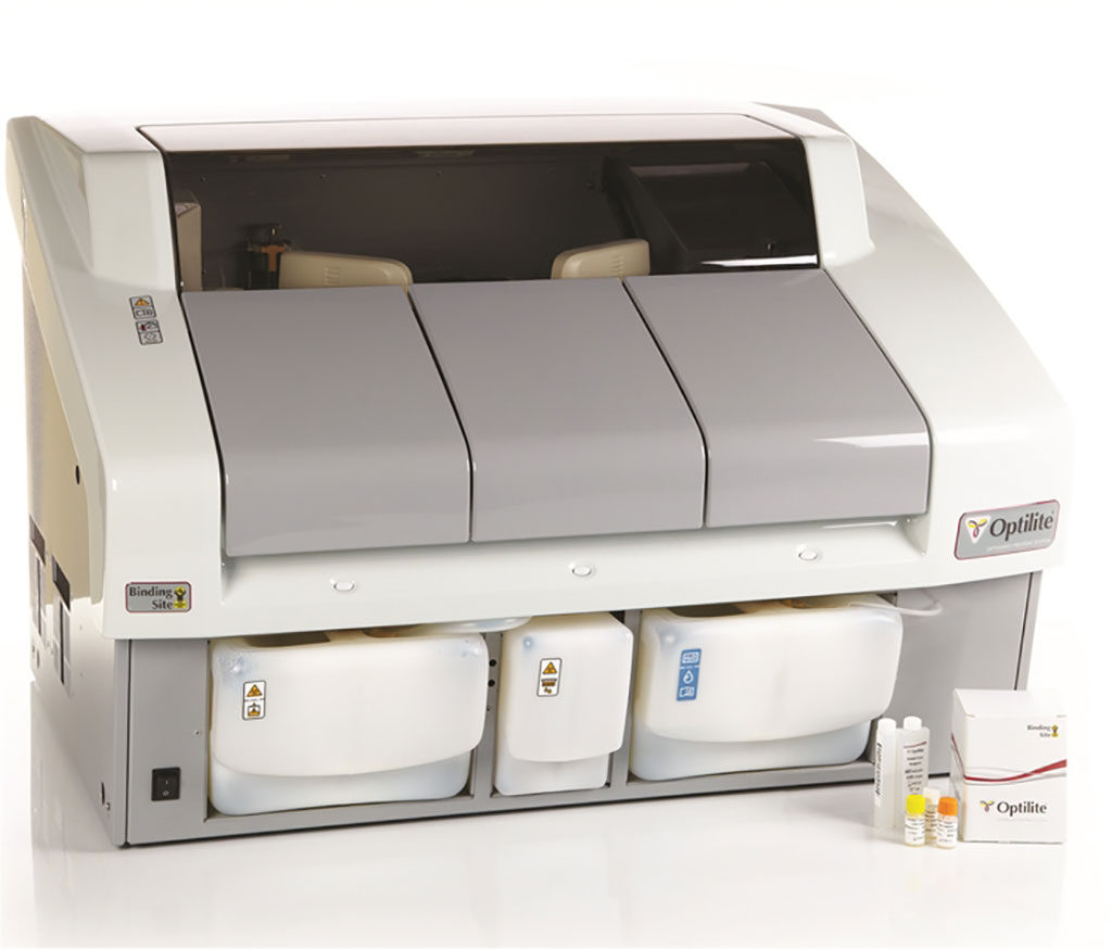 Image: The Optilite is a true benchtop analyzer and fully optimized for Protein Analysis (Photo courtesy of The Binding Site)