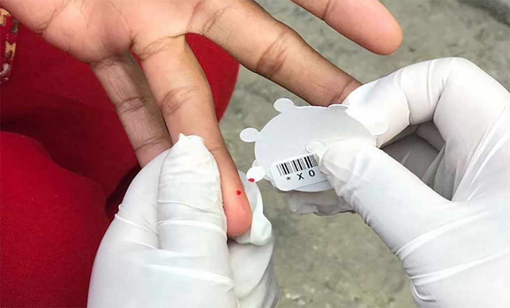 Image: A new method to detect typhoid uses a small amount of blood taken from a finger (Photo courtesy of UC Davis)