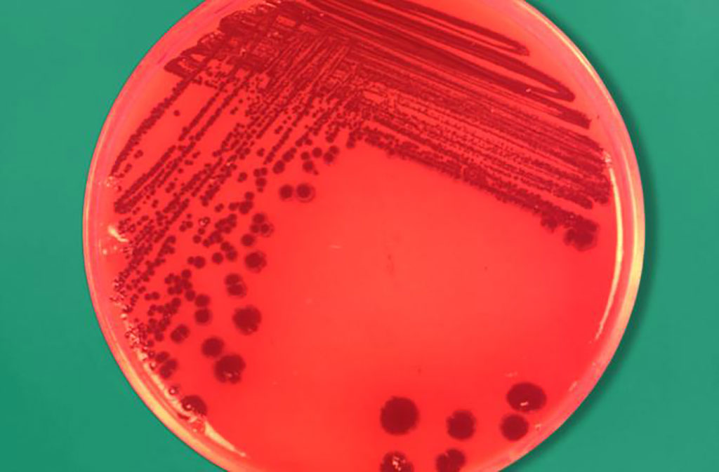 Image: Petri dish culture plate with bacterial colonial growth of Prevotella spp., The men with cancer had increased levels Prevotella-9 (Photo courtesy of Dr. V.R. Dowell)