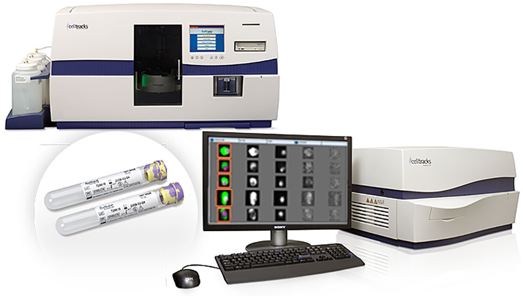 Image: The CELLSEARCH System is the first and only clinically validated, FDA-cleared system for identification, isolation, and enumeration of circulating tumor cells (CTCs) from a simple blood test (Photo courtesy Menarini Silicon Biosystems Inc.)