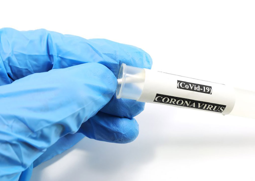 Image: Test tube with swab for coronavirus analysis (Photo courtesy of 123rf.com)