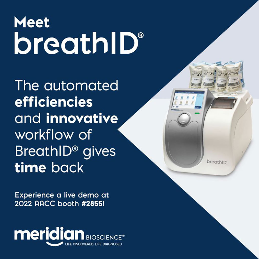 Image: BreathID platform offers a cost-effective clinical diagnostic solution (Photo courtesy of Meridian)