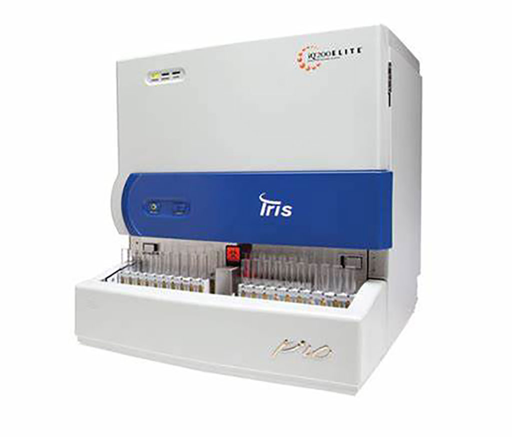 Image: The iQ200 series automated urine microscopy analyzer produces shortened TAT with standardized results (Photo courtesy of Beckman Coulter)
