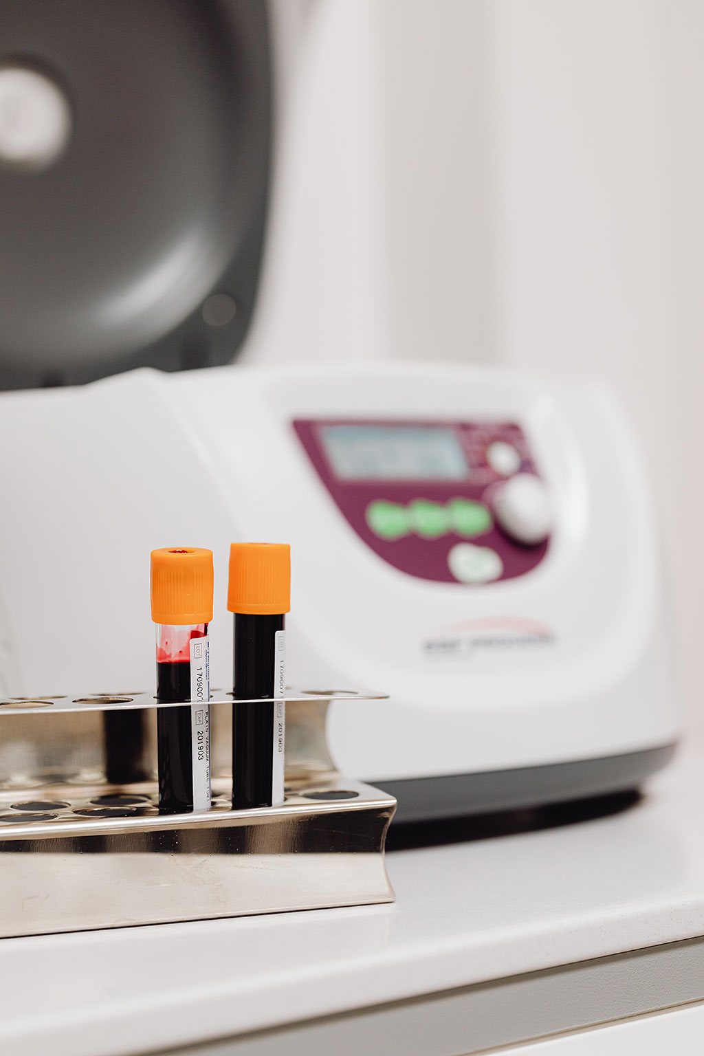 Image: Smartphone clip-on instrument and microfluidic processor rapidly detect Zika virus in whole blood (Photo courtesy of Pexels)