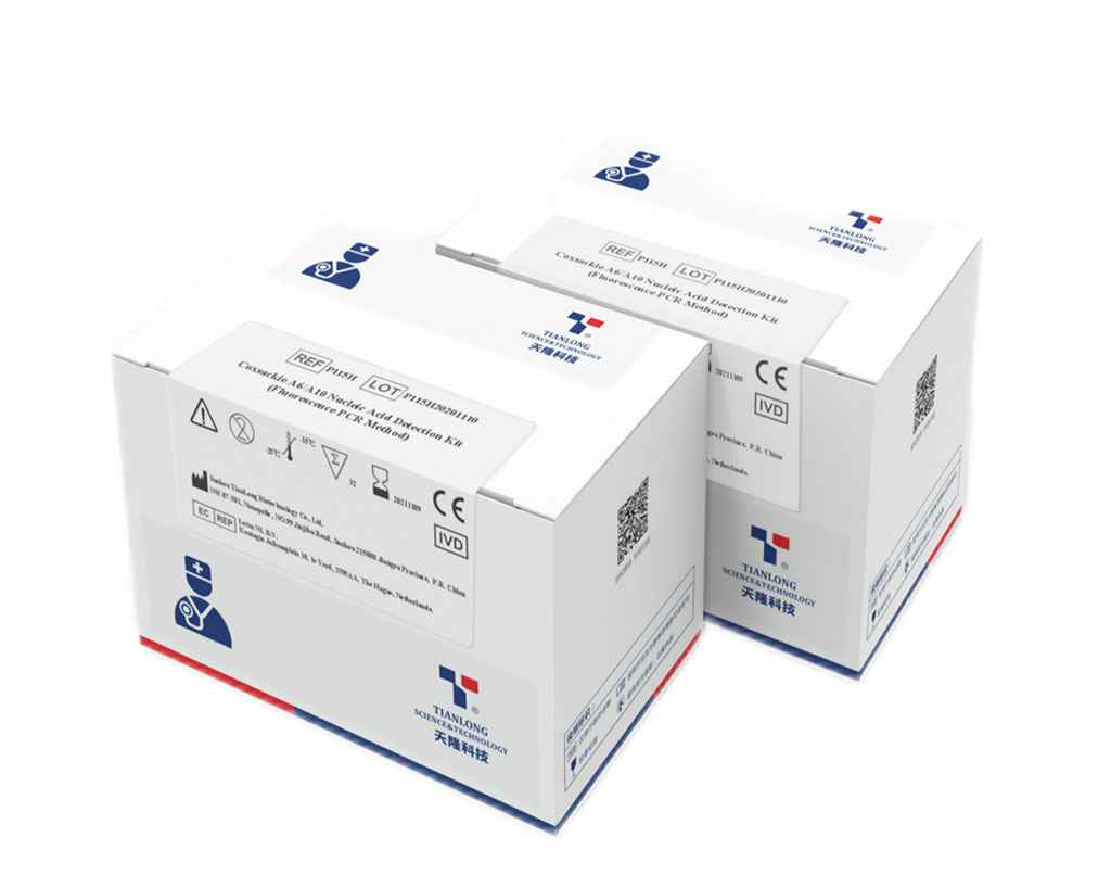Image: Coxsackie A6/A10 Nucleic Acid Detection Kit (Photo courtesy of Tianlong)