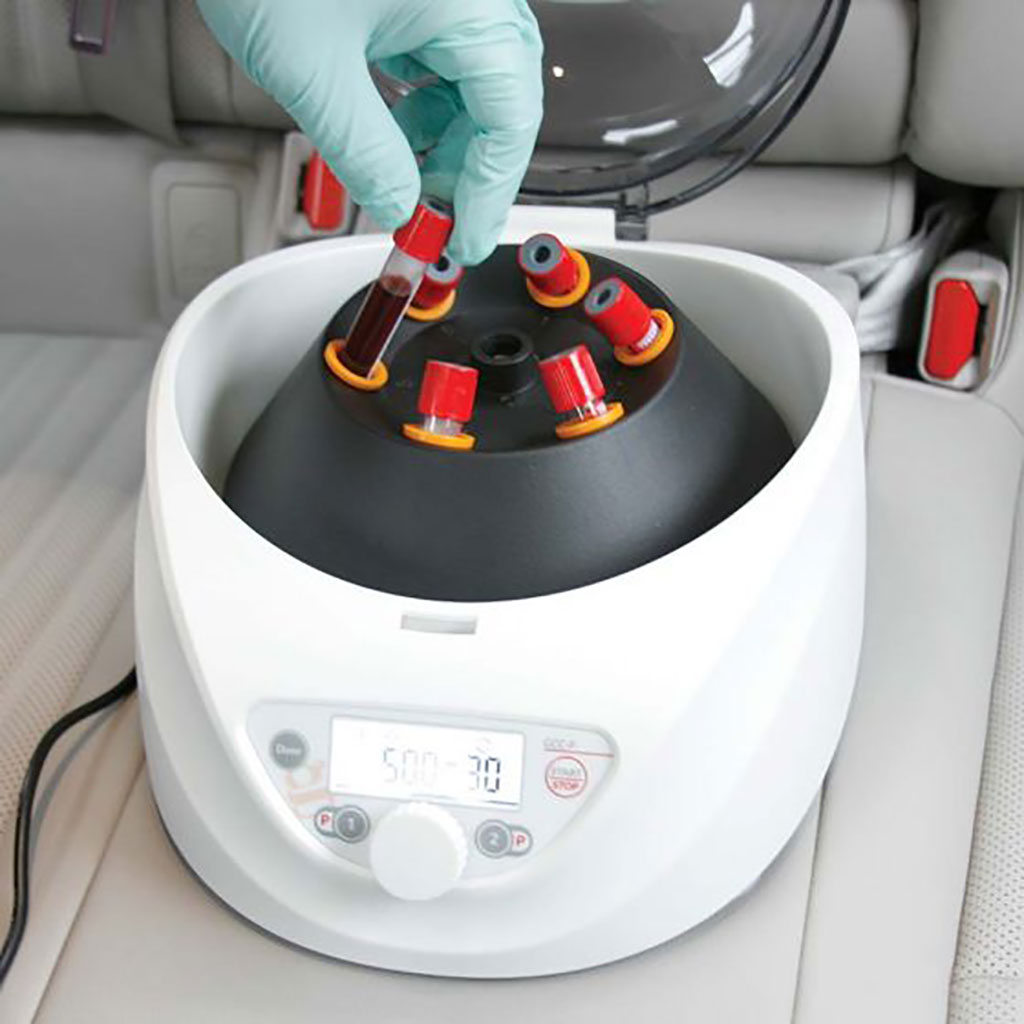 Image: GCC-P portable clinical centrifuge is designed for easy transport (Photo courtesy of Globe Scientific)