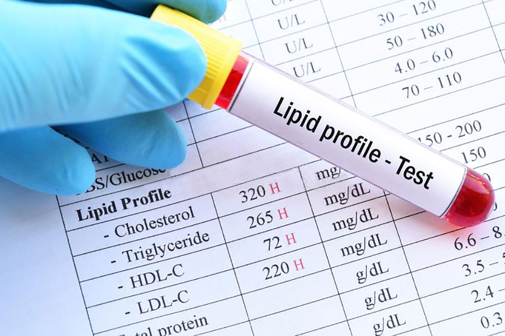 Image: Lipid cutoffs defined for increased cardiovascular disease risk in non-diabetic young people (Photo courtesy of Dreamstime)