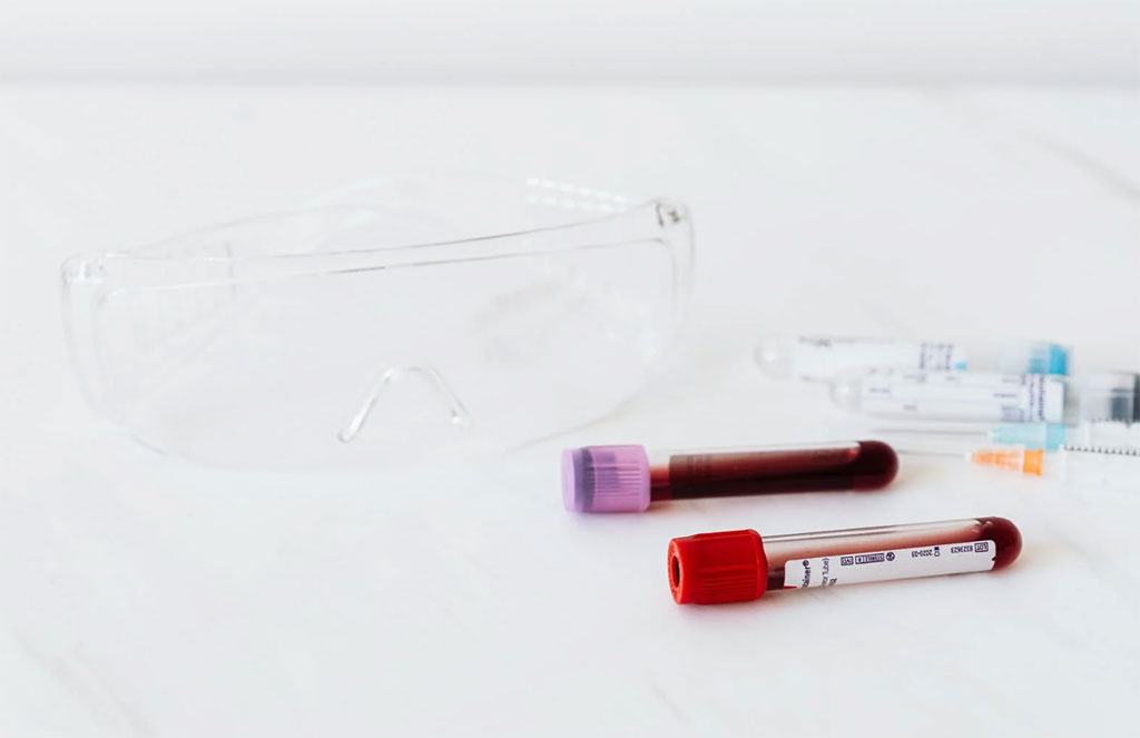Image: A new blood test could noninvasively and inexpensively detect colorectal cancer (Photo courtesy of Pexels)