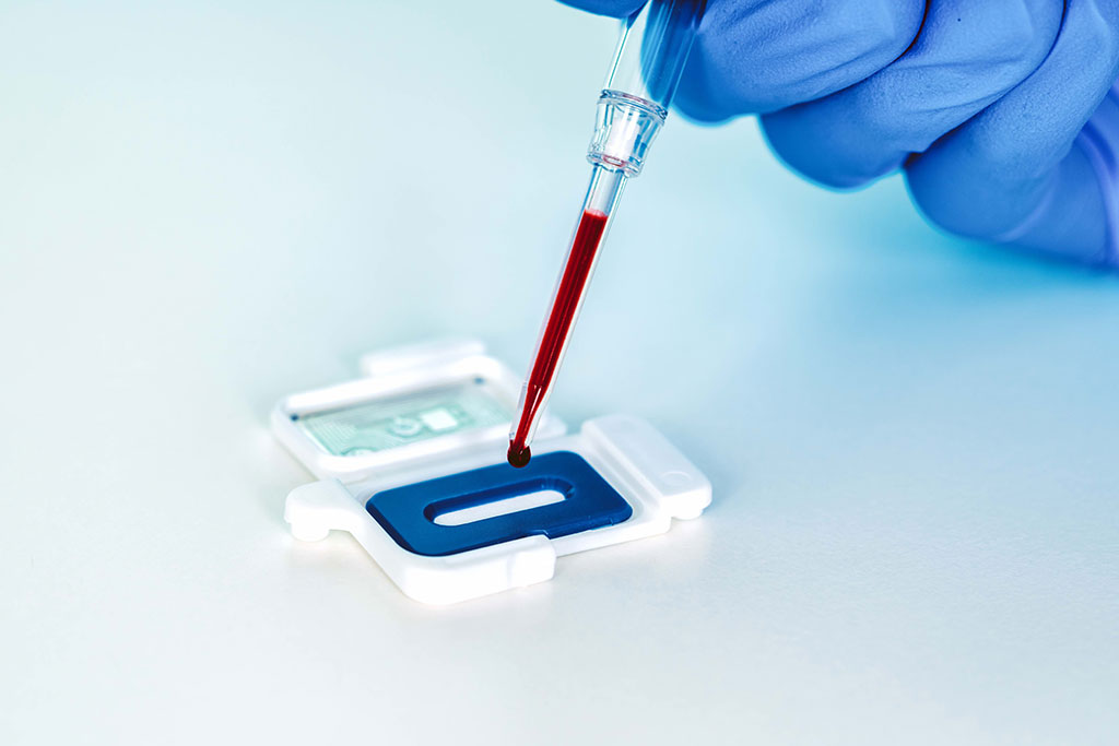Image: Predictive ultra-rapid sepsis test enables management of antibiotic administration (Photo courtesy of Abionic SA)