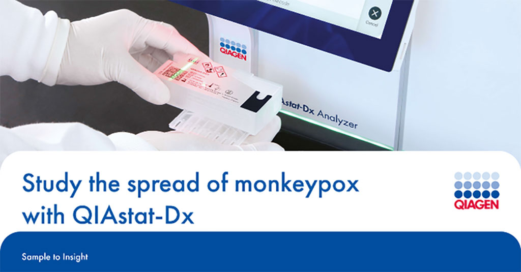 Image: The new multiplex QIAstat-Dx Viral Vesicular Panel is designed to support research and surveillance efforts (Photo courtesy of QIAGEN)