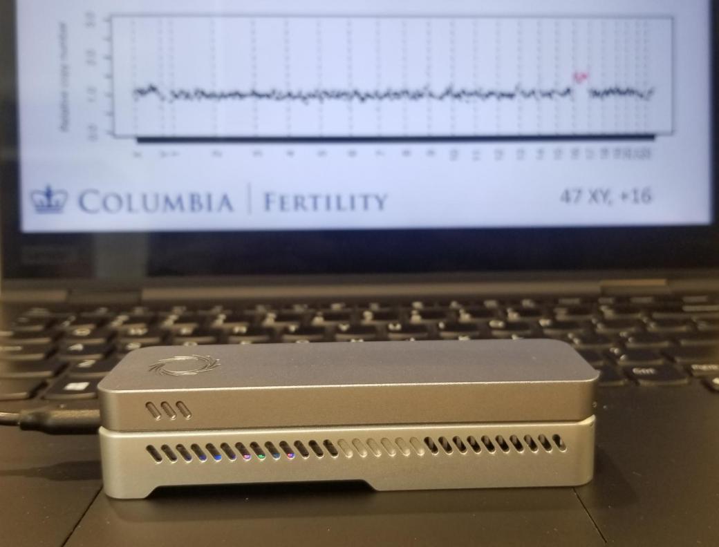 Image: Results from STORK prenatal genetic test, shown in foreground (Photo courtesy of Columbia University Irving Medical Center).