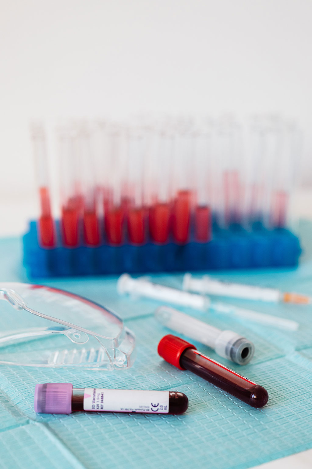 Image: The global hematology diagnostics market is expected to surpass USD 5.5 billion by 2026 (Photo courtesy of Pexels)