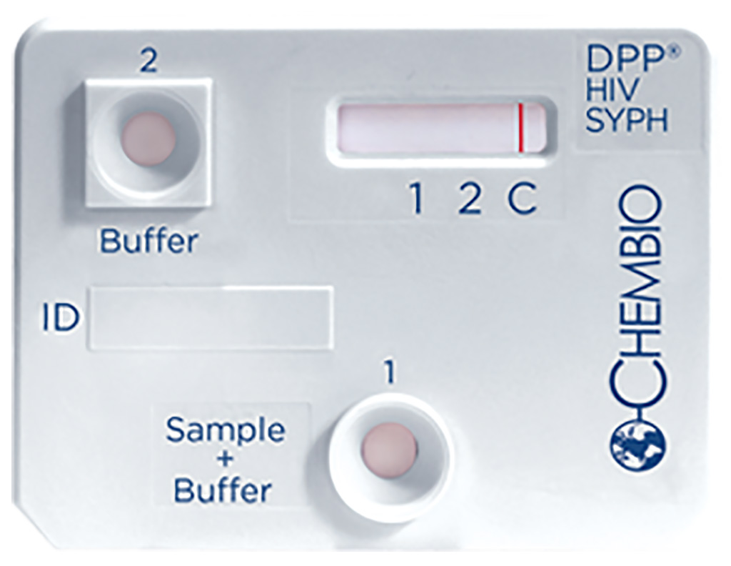 Image: The DPP HIV-Syphilis System is PMA approved (Photo courtesy of Chembio)