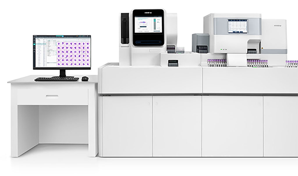 Image: The MC-80 digital cell morphology analyzer can screen and diagnose malignant and non-malignant blood diseases (Photo courtesy of Mindray)