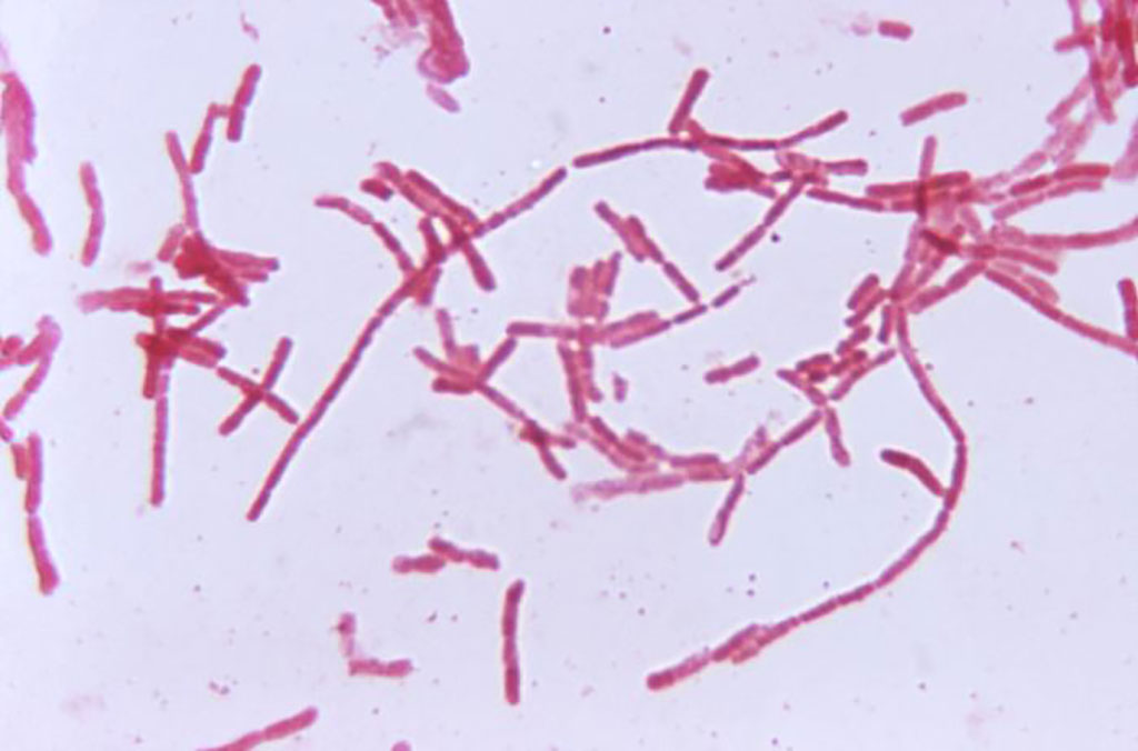 Image: Photomicrograph of the bacterium, Bacteroides hypermegas after being cultured in a thioglycollate medium, for a 48 hour time period. Members of the genus Bacteroides are anaerobic, Gram-negative bacteria, which are mainly found in the intestine, as normal flora (Photo courtesy of Dr. V. R. Dowell, Jr.)