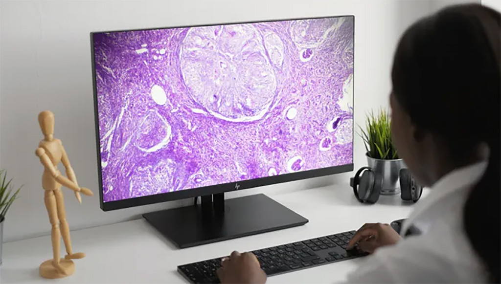 Image: PathFlow Viewer and Automated Workflow are now European regulatory cleared for use in primary diagnosis (Photo courtesy of Gestalt)