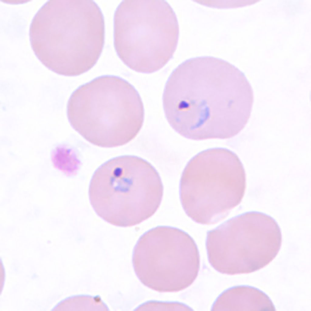 Image: Ring-form trophozoites of Plasmodium vivax in a thin blood smear (Photo courtesy of Centers for Disease Control and Prevention)