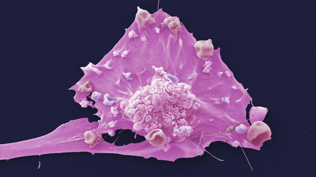 Image: Breast cancer cell (Photo courtesy of Francis Crick Institute)