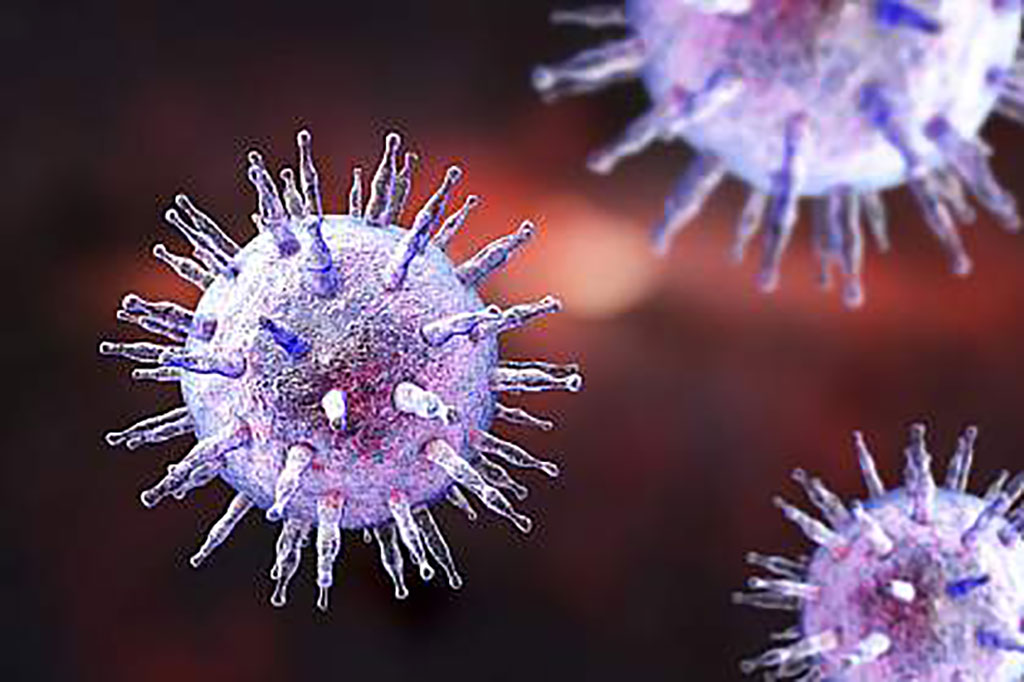 Image: Infections by Epstein-Barr virus usually cause no symptoms, but a growing body of evidence suggests it plays a role in multiple sclerosis (Photo courtesy of Kateryna Kon, MD, PhD)