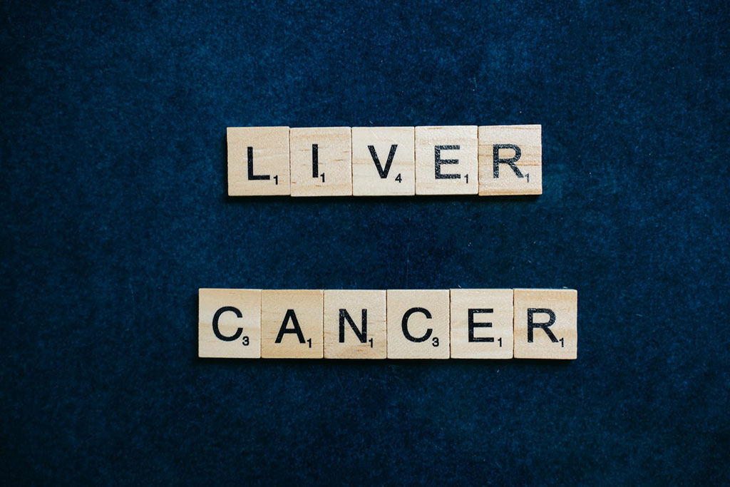 Image: Liver cancer is the third leading cause of cancer deaths worldwide (Photo courtesy of Pexels)