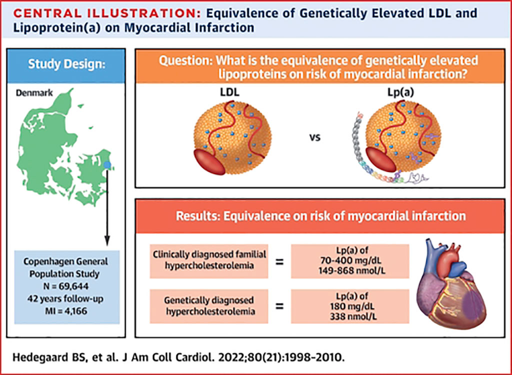 Image: Equivalence of Genetically Elevated LDL and Lipoprotein(a) on Myocardial Infarction (Photo courtesy of Viborg Regional Hospital)