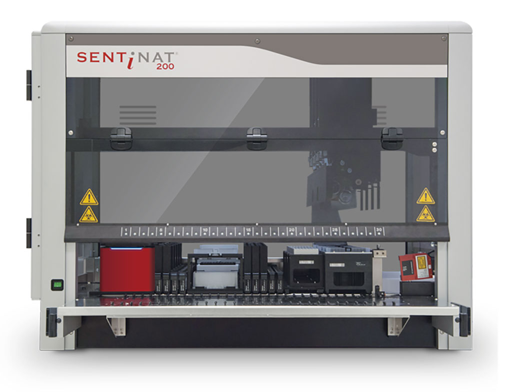 Image: The SENTiNAT 200 platform contains everything labs need to perform complete PCR analysis (Photo courtesy of Sentinel Diagnostics)
