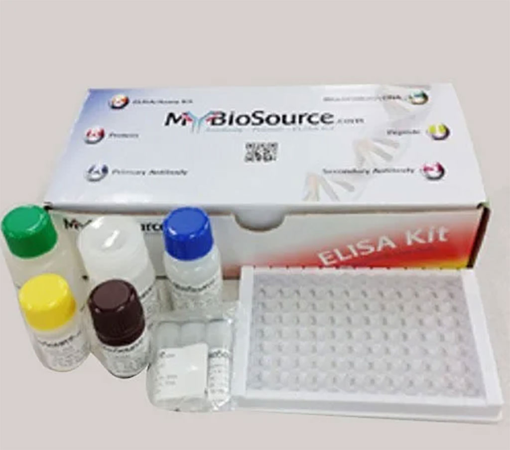 Image: Enzyme-linked immunosorbent assay were used to measure serum levels of IL-37, IL-38, and Vitamin D (Photo courtesy of MyBioSource Inc)