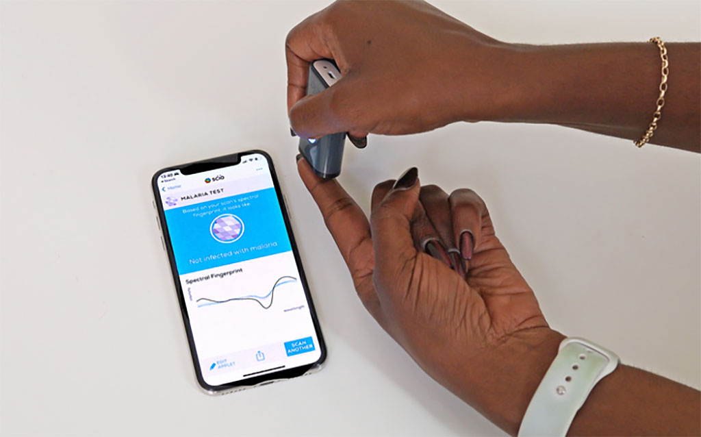 Image: The malaria detection tool collects an infrared signature for a mobile phone to process (Photo courtesy of The University of Queensland)