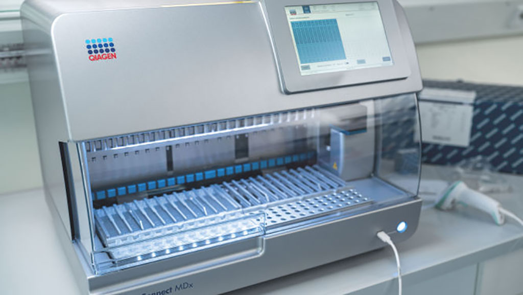 Image: The EZ2 Connect MDx is designed for fast automated nucleic acid extraction in IVD workflows (Photo courtesy of QIAGEN)