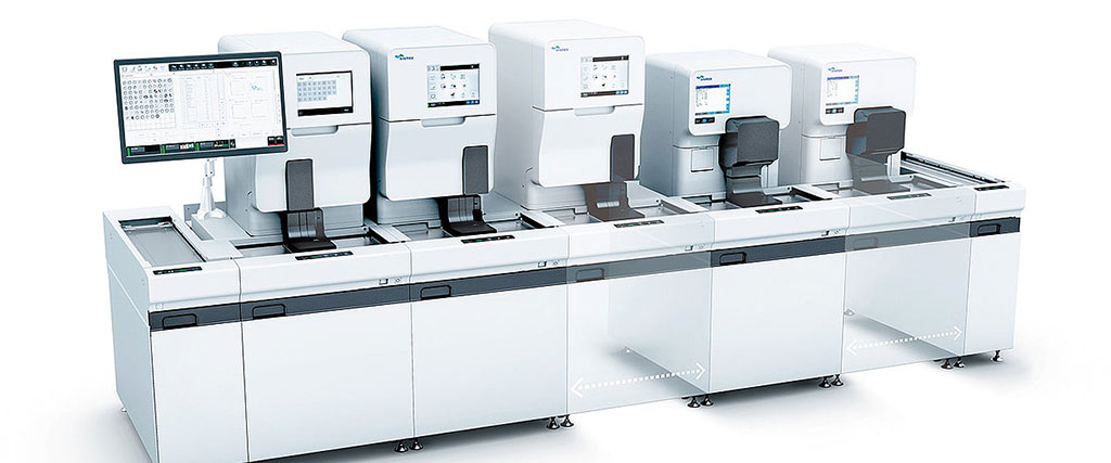 Image: The UN-Series can automate a lab’s urinalysis work area according to workflow preferences (Photo courtesy of Sysmex)